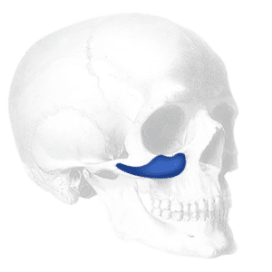 types of cheek implants; submalar implants